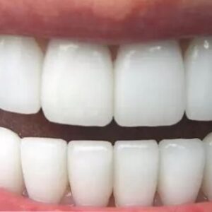 Beyaz Diş Adana